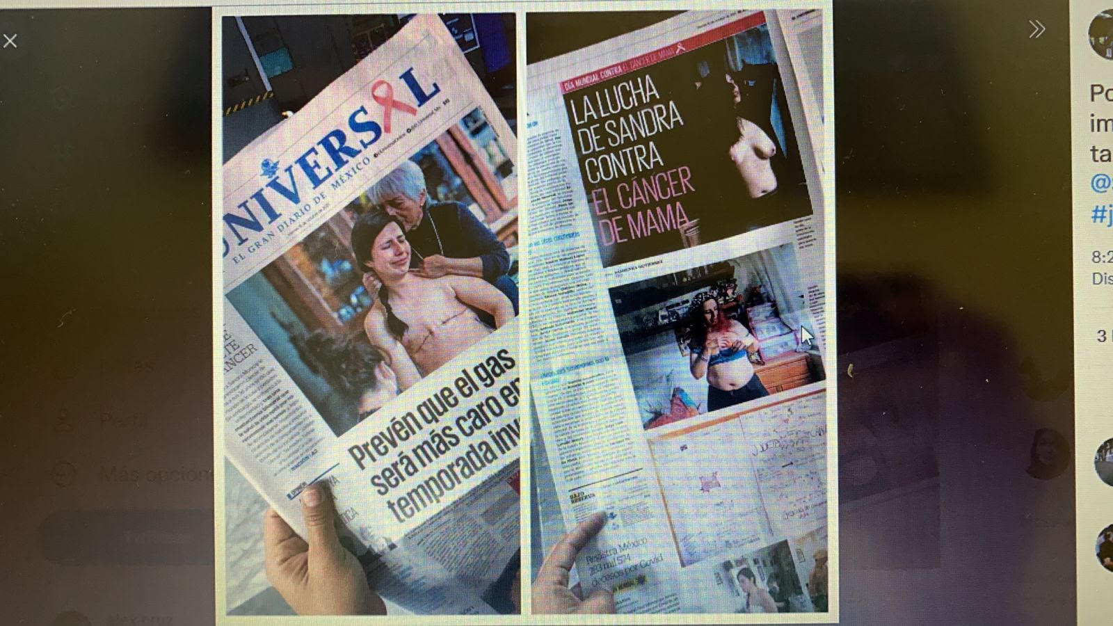 reportaje cáncer de mama